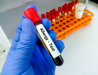 Fototapeta premium Test tube with blood sample for food allergy test.