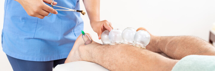 Vacuum Cupping Therapy Banner. Young female physiotherapist applying glass suction banks on the leg...