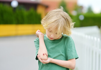 Cute little boy looking on his elbow with wound. Child healthcare and medicine concept. First aid...