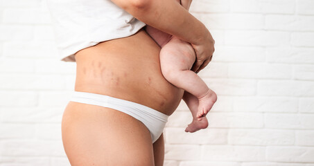 Fototapeta The belly of a woman after the birth of a child. Baby's legs on a woman's stomach on a white background obraz