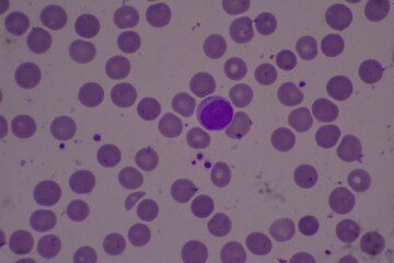Adequate of platelet in blood smear.