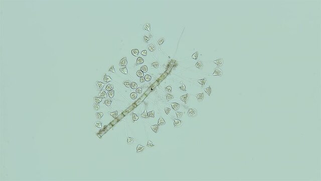 Infusoria Ciliophora Vorticella under the microscope, class Oligohymenophorea.