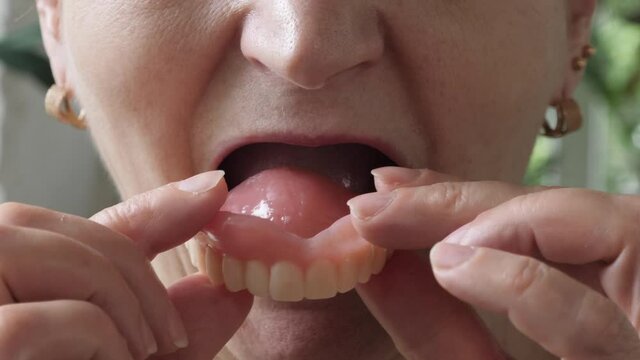 Woman fitting denture and smiling at camera. Mouth of female with false teeth