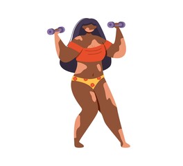 An African American woman with vitiligo exercises with small dumbbells.