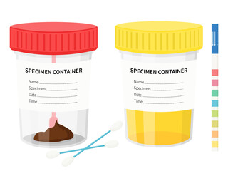 Laboratory tests. Test urine, feces in plastic jars with colored lids. illustration in flat style