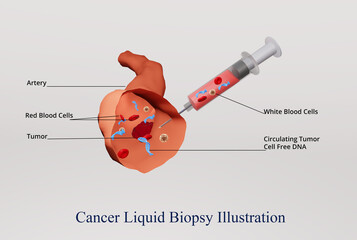 #D illustration showing Cancer Liquid Biopsy procedure
