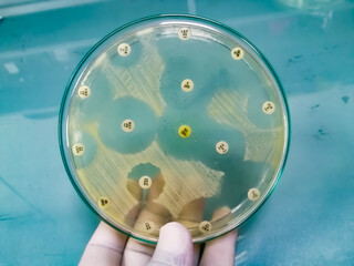 Antimicrobial susceptibility testing in petri dish with Muller Hinton agar medium,Susceptibility of Staphylococcus aureus bacteria