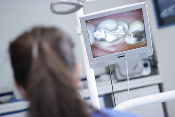 mujer viendo en monitor amalgama dental