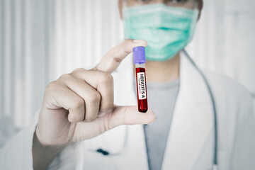 Male doctor shows blood sample tube of Hepatitis A