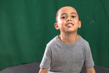 Cute caucasian young kid holding yellow lollipop showing broken milk tooth..Studio portrait,...