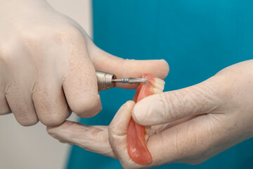 Preparación de una prótesis dental