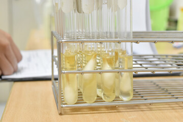 laboratory microbiology bacteria agar tube in incubator quality control process.