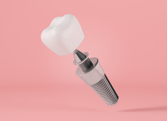 Dental implant on pink background, 3d rendering