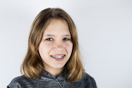 Dental braces on the teeth of a young cute girl smiling on a light background. Copy space