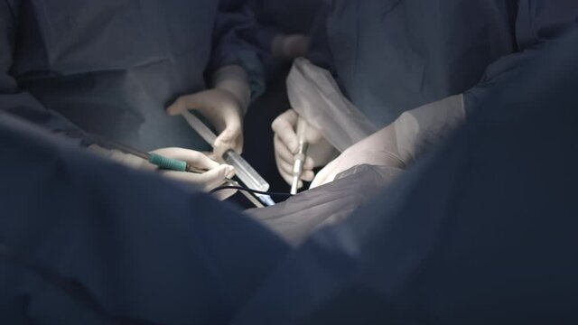 Modern surgical operating room. Surgeons team performing operation in surgery room.  
Close-up Shot in the Operating Room. brain surgery