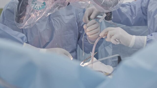 Modern surgical operating room. Surgeons team performing operation in surgery room.  
Close-up Shot in the Operating Room. brain surgery