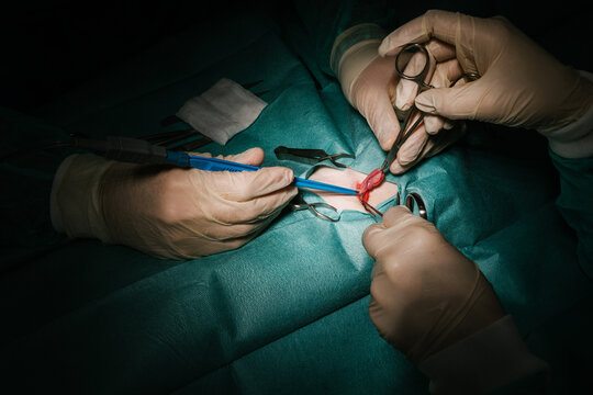Light that focuses on the anonymous hands of surgeons operating in a clinic.