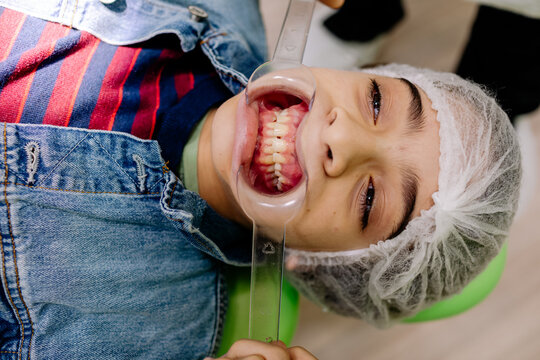 Teen boy with mouth opener during appointment in dental clinic
