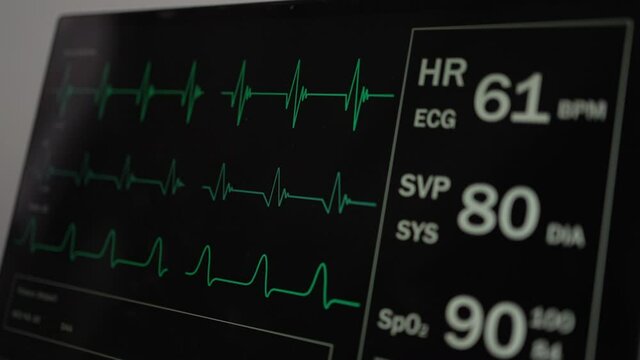 Looped: Patient monitor displays vital signs ECG electrocardiogram EKG, oxygen saturation SPO2 and respiration. Medical examination. 4K video footage animation. Cardiac monitoring. Electrocardiograph