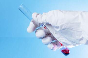 Medical laboratory. A gloved hand holds a test tube of blood on a blue background. Elements of a...