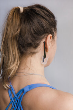 Medicinal leech hanging behind an ear