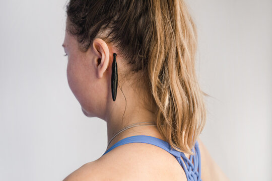Medicinal leech working behind ears