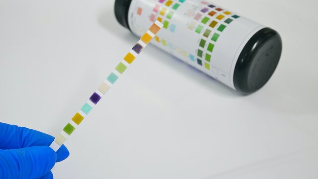 Srip test urinalysis in laboratory.