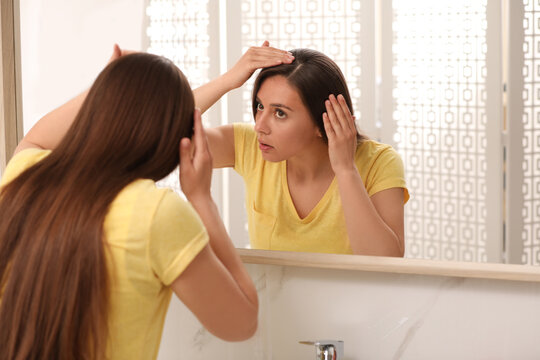 Young woman with hair loss problem looking in mirror indoors