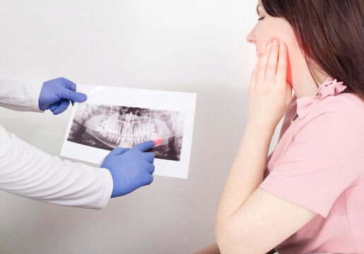 A dentist doctor is holding a panoramic X-ray picture of a female patient who has an inflamed dental cyst, a neoplasm. Removal of a dental cyst
