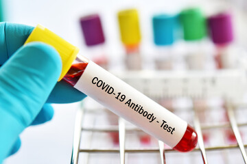 COVID-19 antibody test, blood sample tube for COVID-19 antibody test, after vaccination or infection