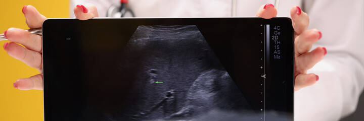 Doctor holding digital tablet with ultrasound image closeup