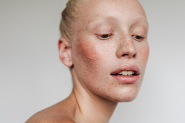 Freckled model with clay mask