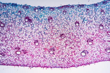 gallnut plant cells micrograph