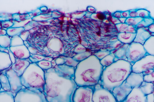 gallnut plant cells micrograph