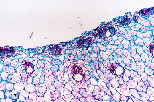 gallnut plant cells micrograph