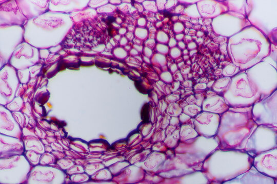 gallnut plant cells micrograph