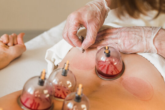 Good incisions maker