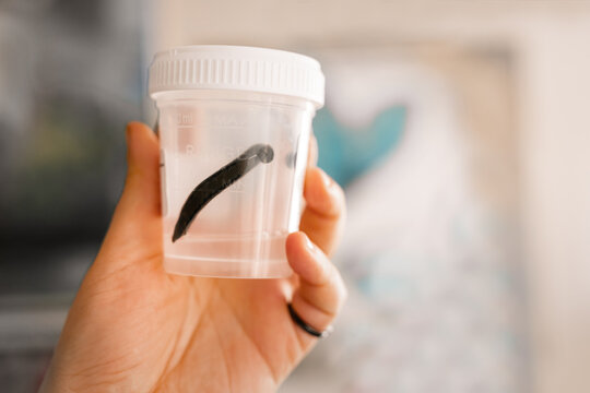 Medicinal leech 