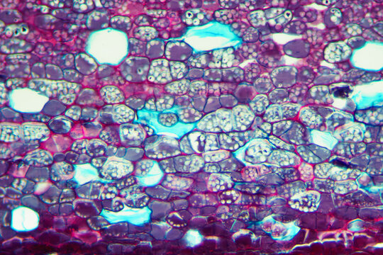 Cinnamon bark plant cells micrograph