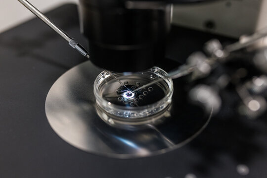 In vitro feralization under microscope in lab