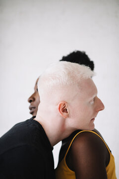 Portrait of a young black woman and male albino