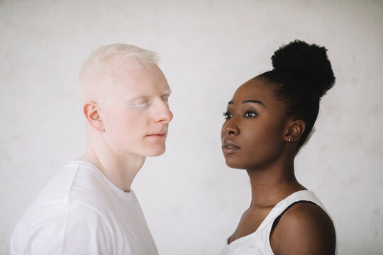 Portrait of a young black woman and male albino