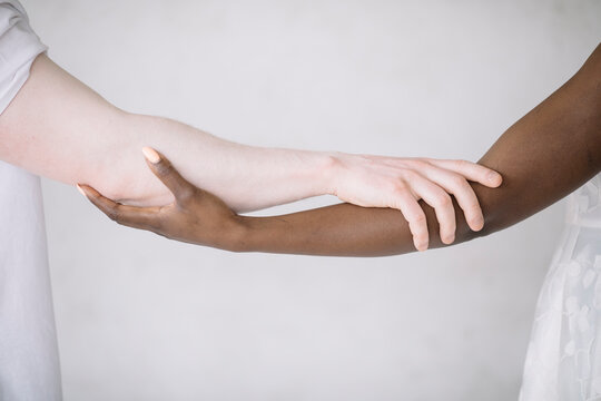 Black woman and male albino holding hands close up