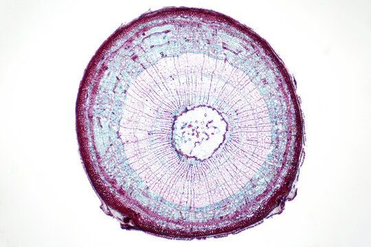 Cross sections of plant stem under light microscope view.