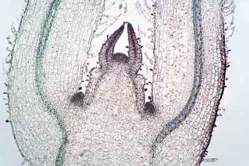 Shoot meristem is the tissue in most plants containing undifferentiated cells.