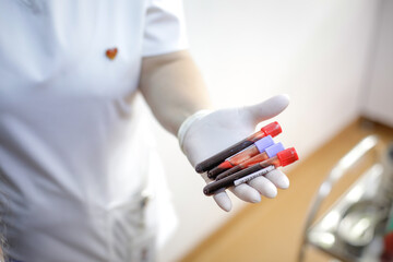 Fototapeta na wymiar Shallow depth of field (selective focus) details with a female medical worker holding blood vials after a blood donation.