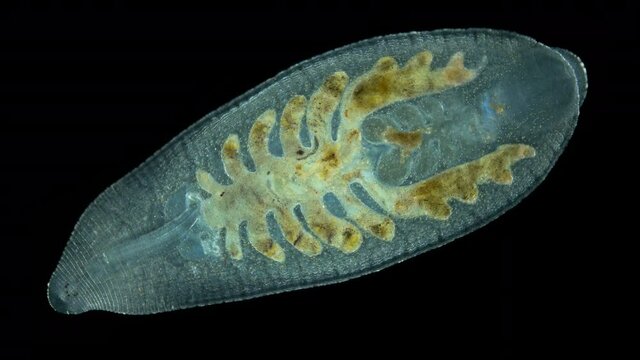 Leech Alboglossiphonia sp. under a microscope, family Glossiphoniidae, order Rhynchobdellida. Sample size 5 mm, Lives in fresh water, feeds on Gastropoda snails