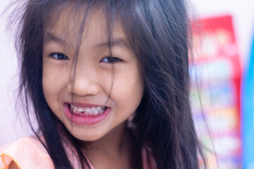 A 5-year-old Asian girl broke her first tooth.