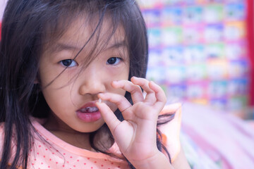 A 5-year-old Asian girl broke her first tooth.