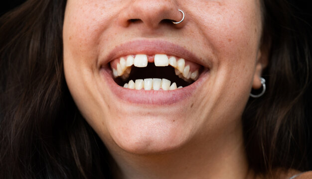 close up of a beautiful woman smiling with diastema